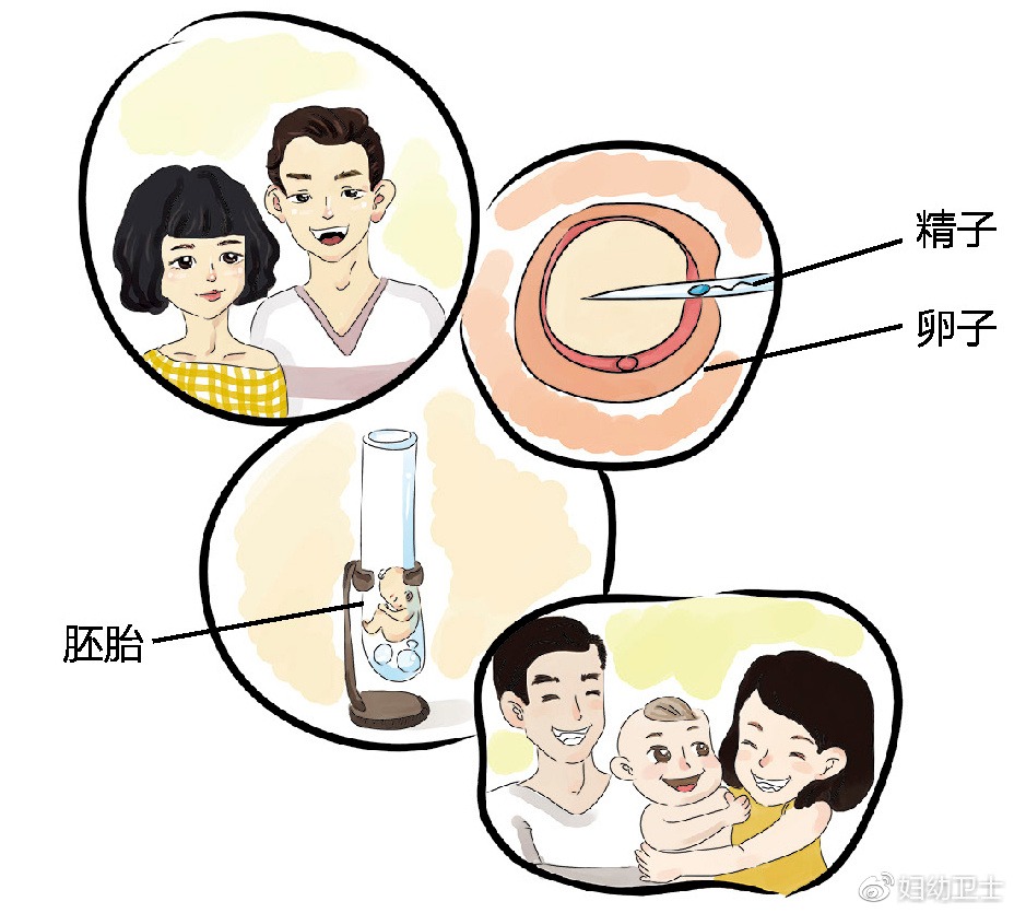 双胞胎