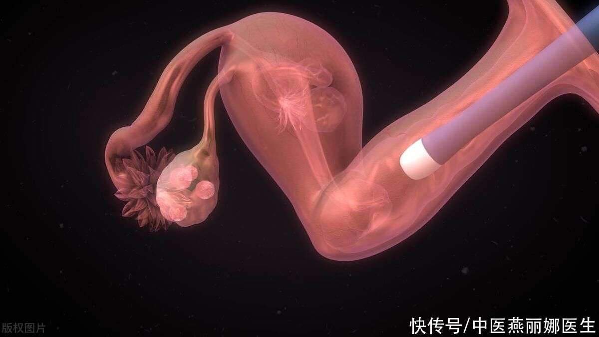 不孕不育