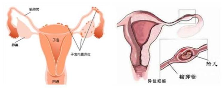 哈尔滨医大试管婴儿