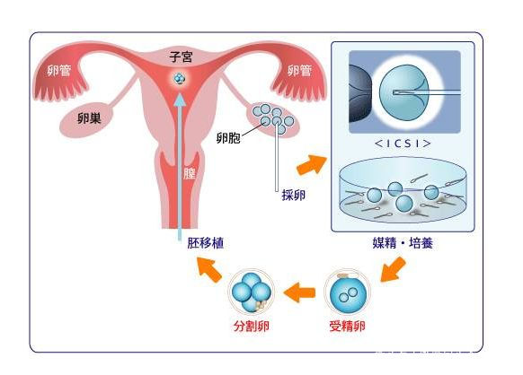 台湾试管婴儿