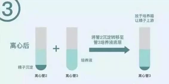 哈尔滨试管婴儿医院