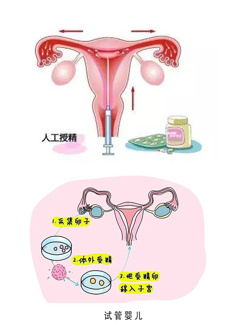 哈医大试管婴儿