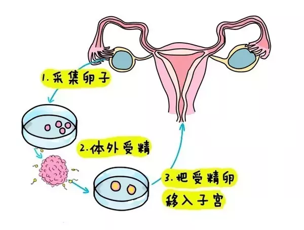 唐山试管