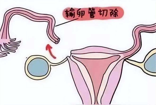 双胞胎